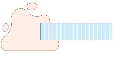 肺结核患者如何日常护理？.am 动画制作软件有哪些